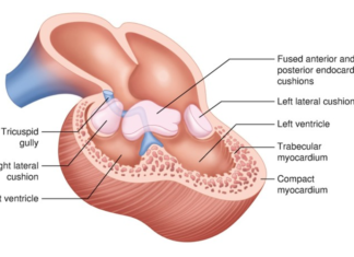 Valve Disorder